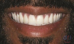 dentistry for life patient after image #2