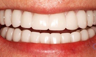 dentistry for life patient after image #1