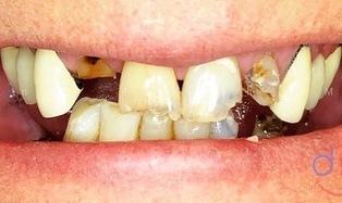 dentistry for life patient before image #1