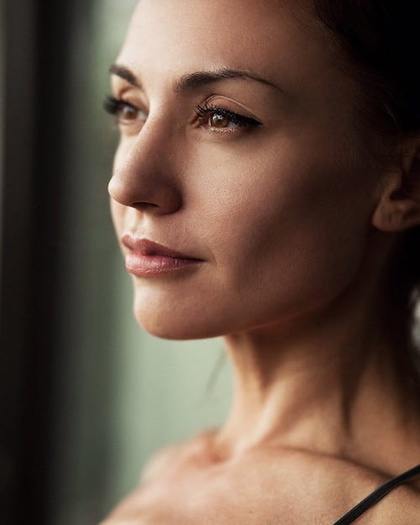 RF Microneedling procedure