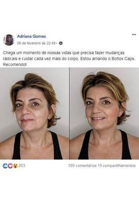 botox caps reclame aqui