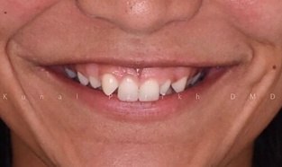 dentistry for life patient before image #3