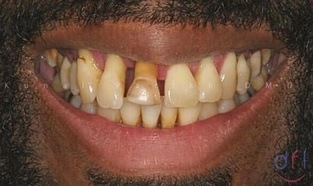 dentistry for life patient before image #2