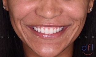 dentistry for life patient after image #3