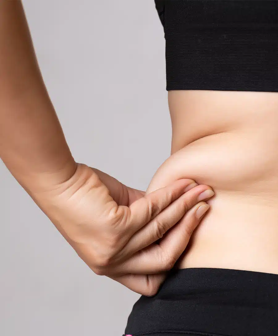 TickleTite liposuction