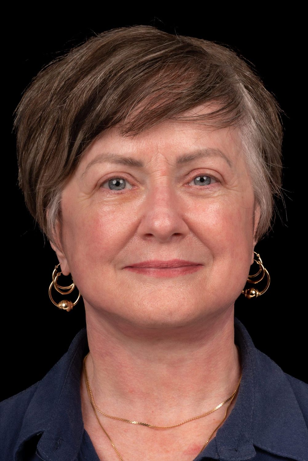 face/neck patient before & After