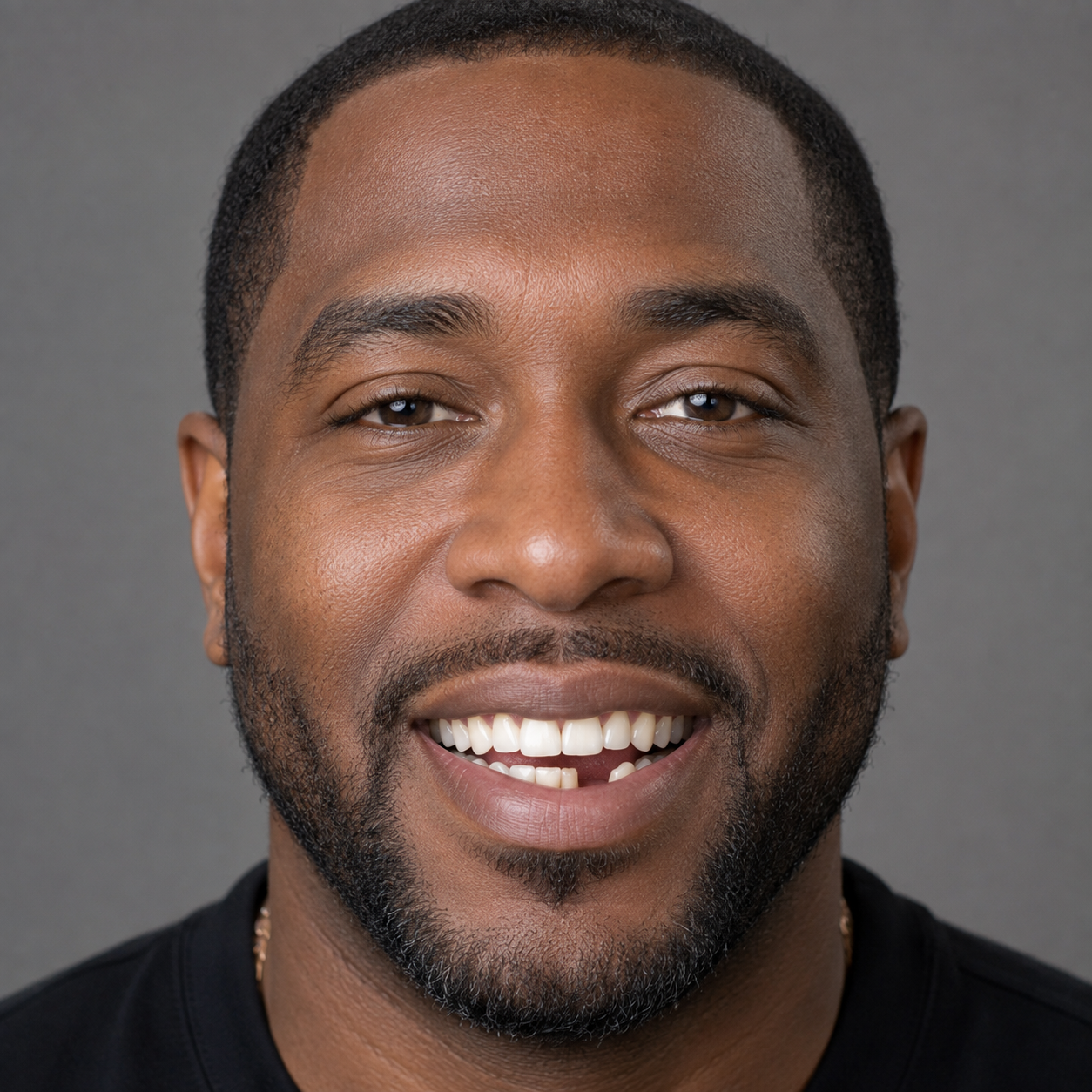 Before front tooth implant, age 38, missing front tooth