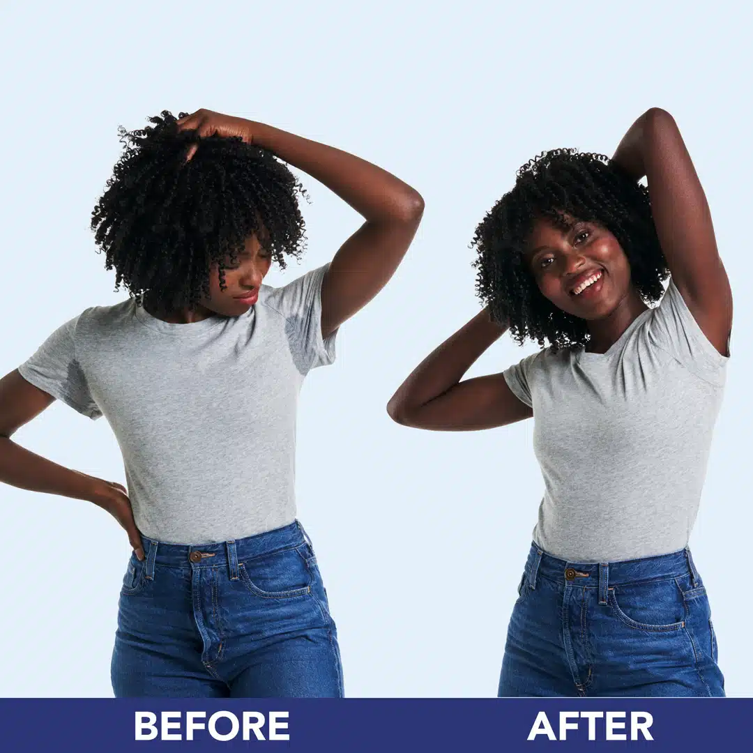 miradry before & after