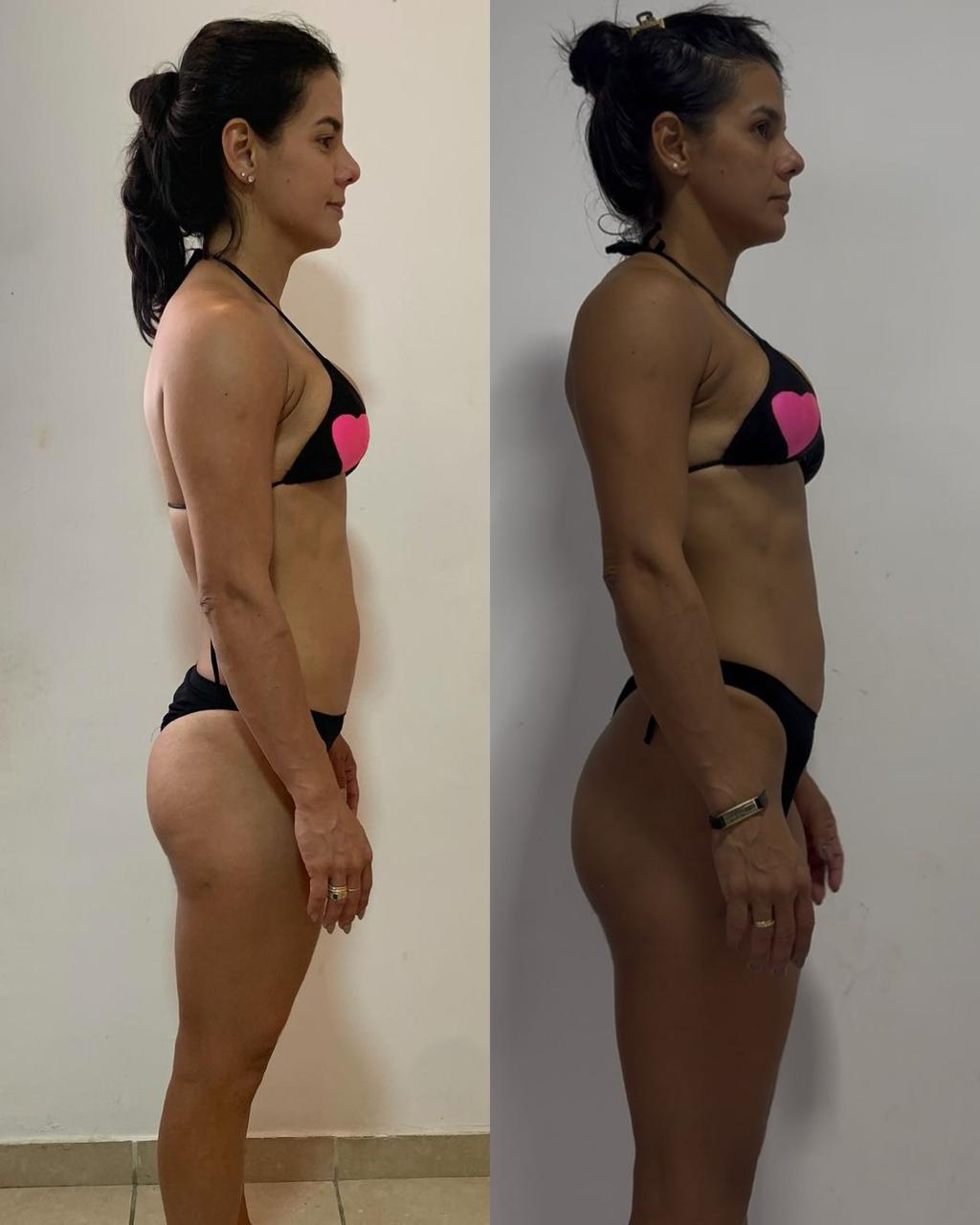 Antes e depois 2
