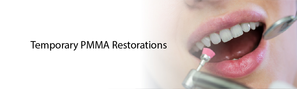Temporary PMMA restorations