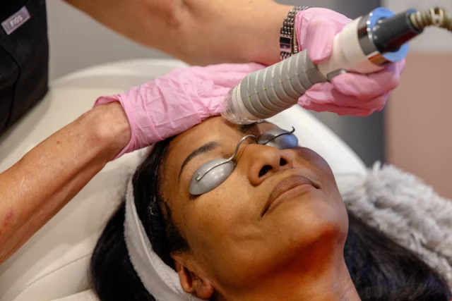 skin tightening treatments at All About Me AZ