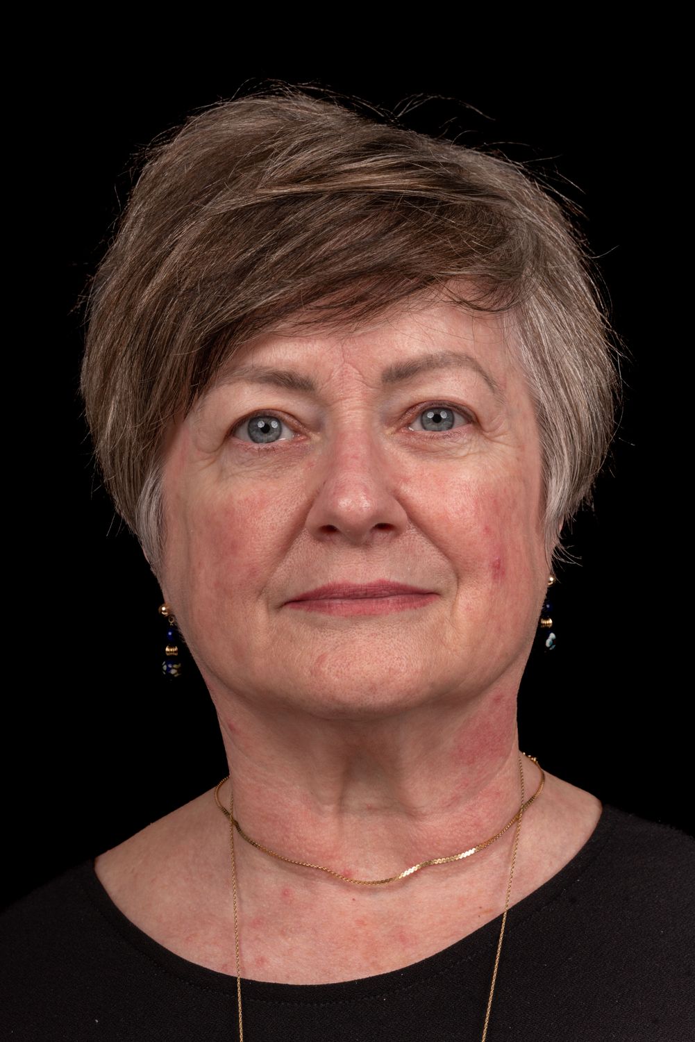 face/neck patient before & After