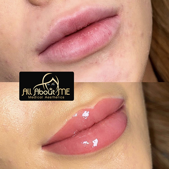 Lip Blushing & Powder brows treatments at All About Me AZ