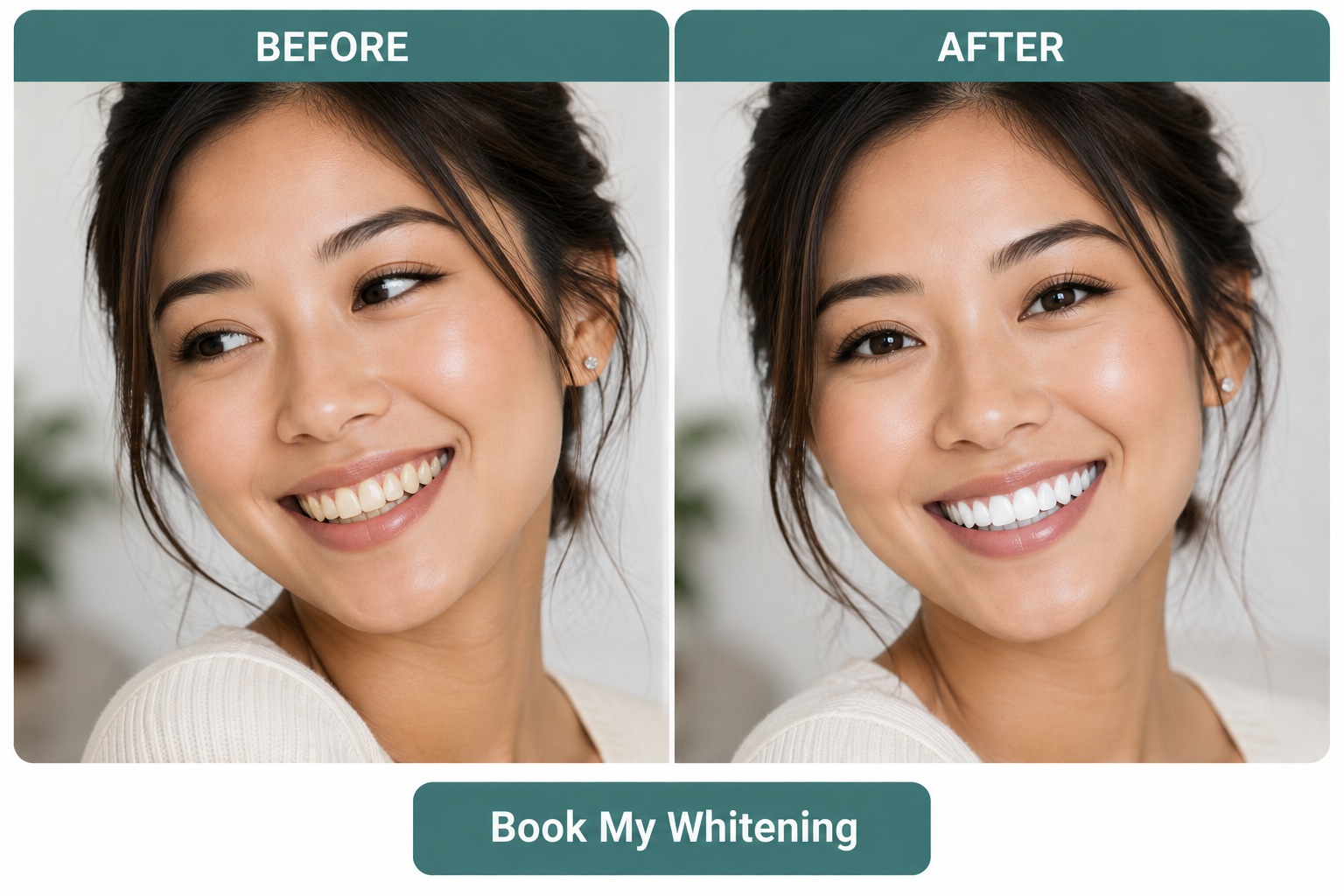 Close-up before and after comparison of teeth whitening transformation