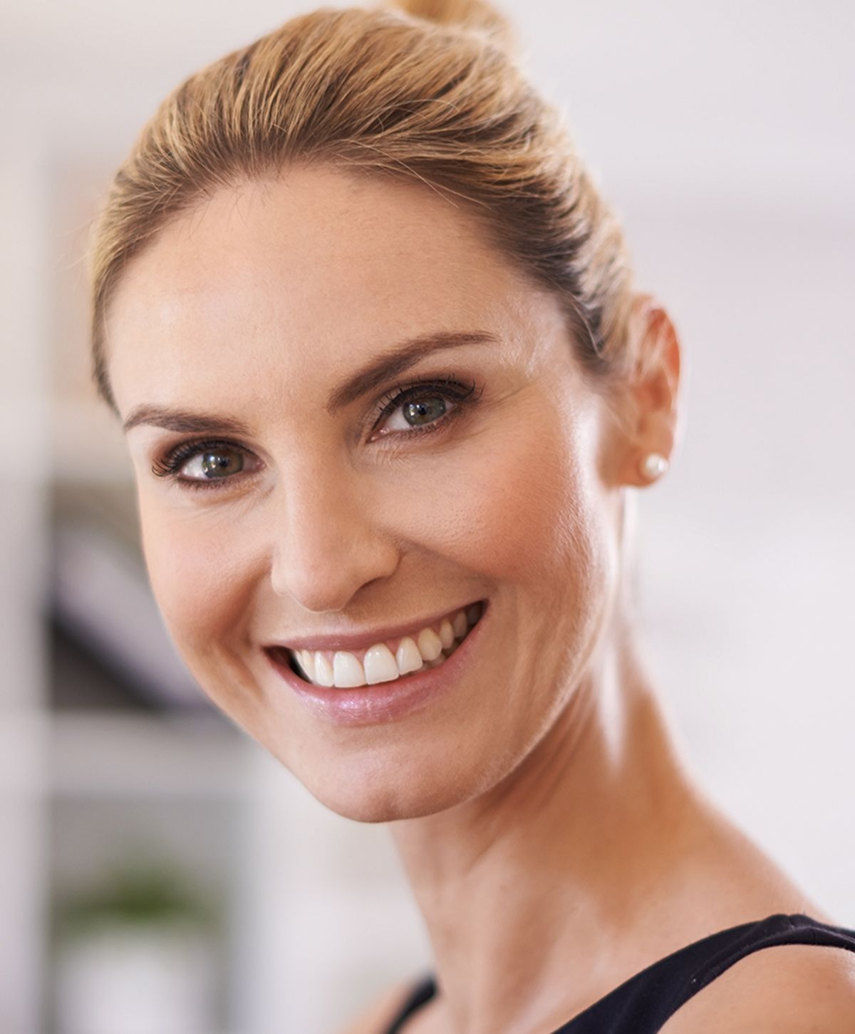 dental implant stock photo