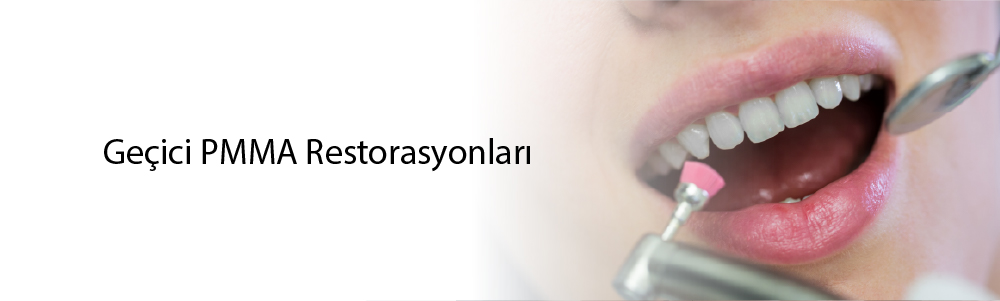 Geçici PMMA restorasyonları