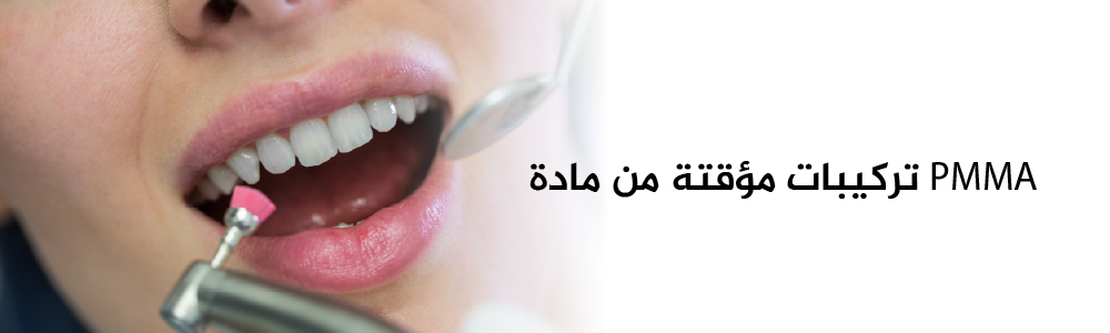 تعليمات العناية للتركيبات المؤقتة المصنوعة من PMMA