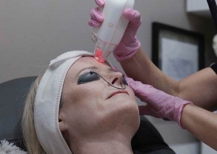 Laser treatments at All About Me AZ