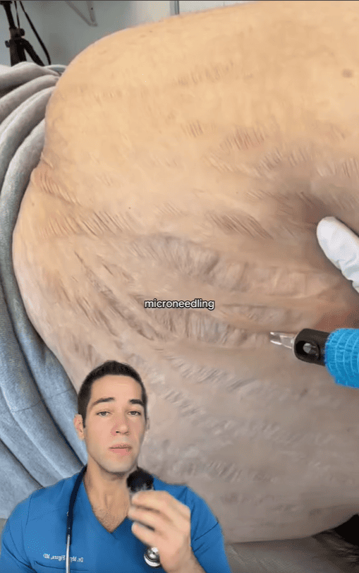 a person's arm with a blue and white sock on it