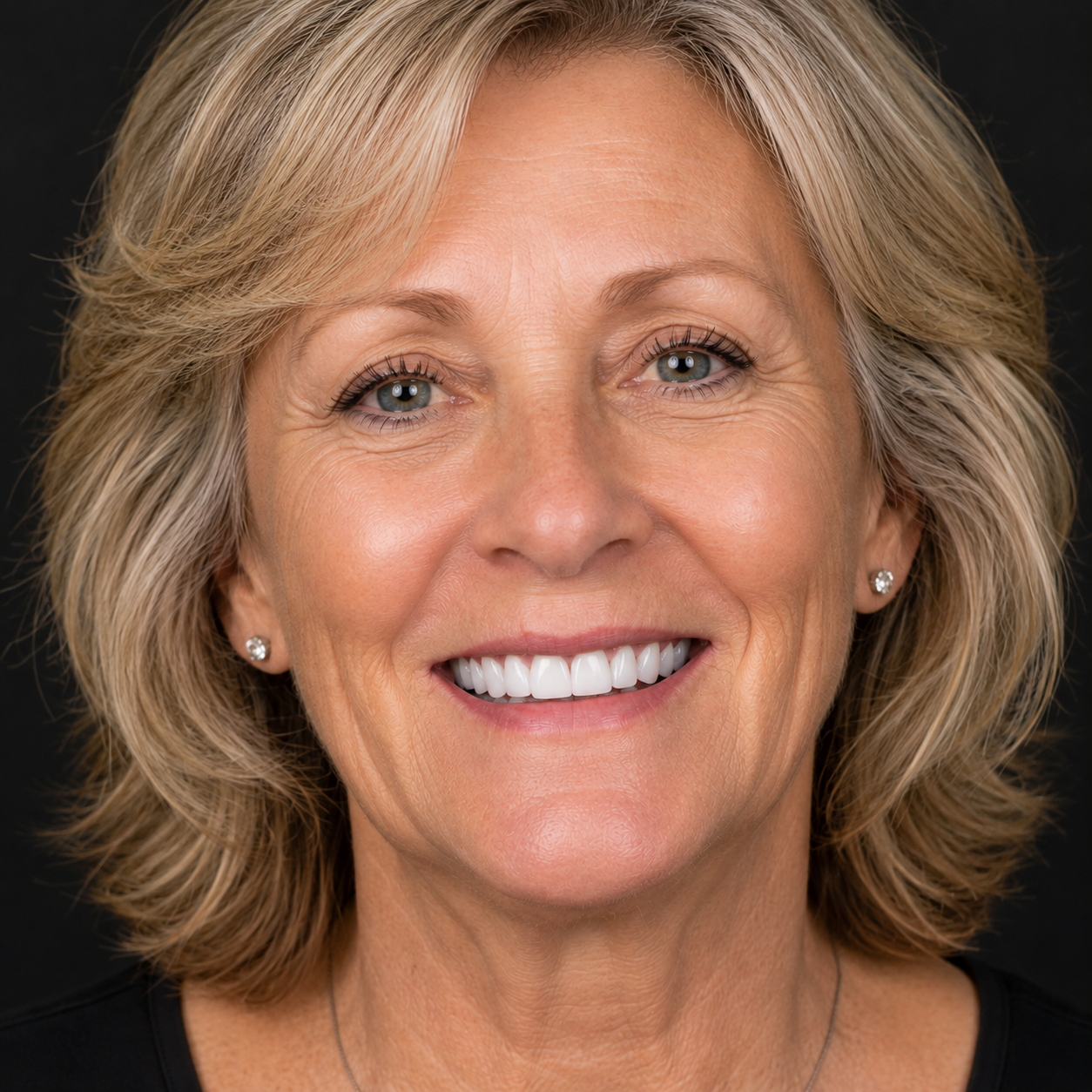 After full arch restoration, complete natural smile, age 61
