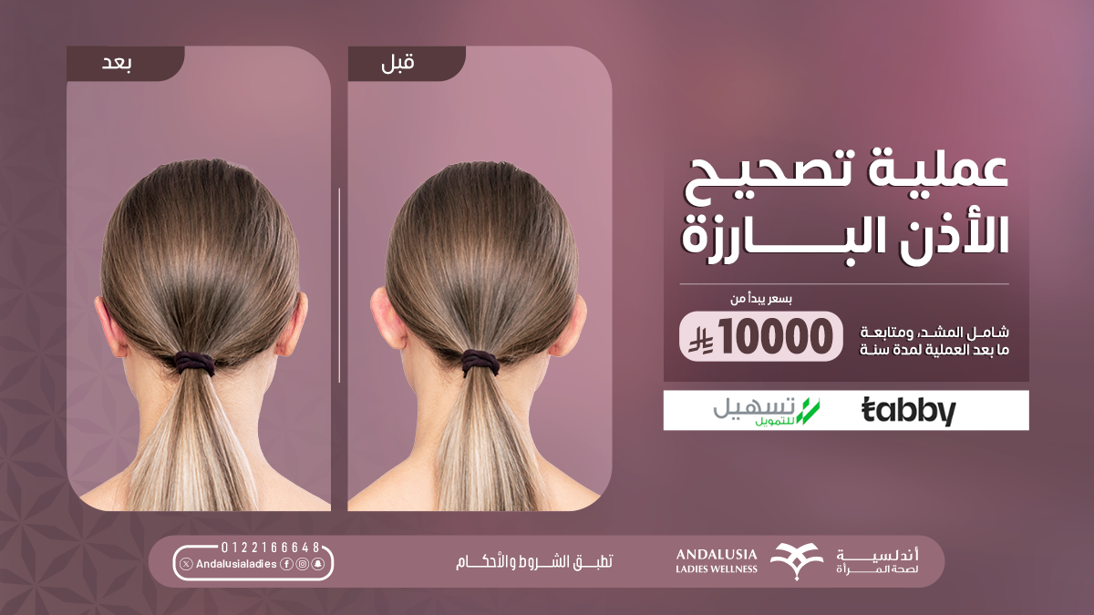 تبييض اسنان بتقنية الزوم عيادة تبييض اسنان بتقنية الزوم افضل عيادة للاسنان بجدة والسعودية