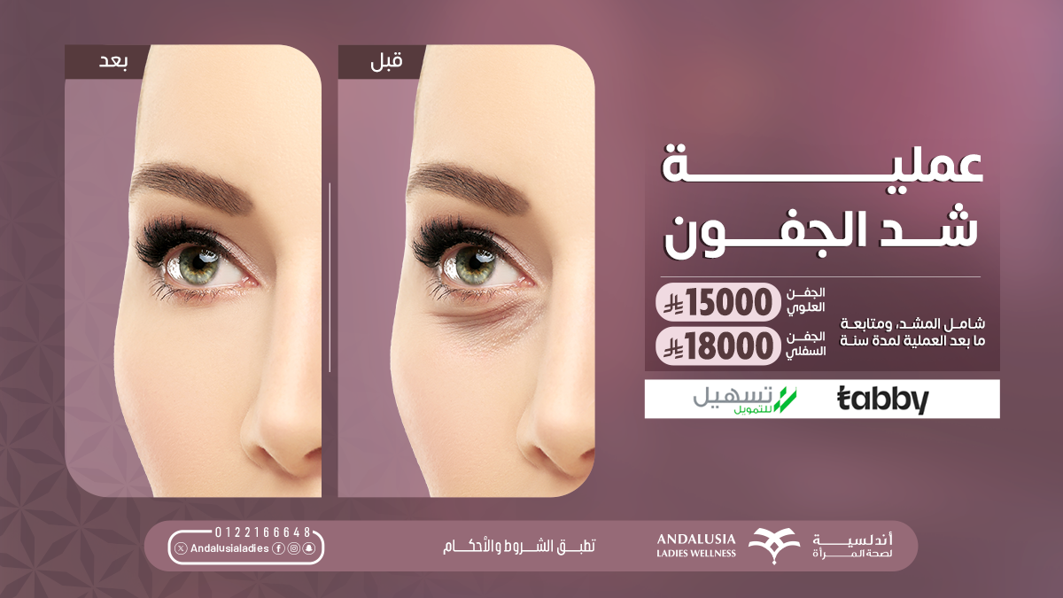 تبييض اسنان بتقنية الزوم عيادة تبييض اسنان بتقنية الزوم افضل عيادة للاسنان بجدة والسعودية