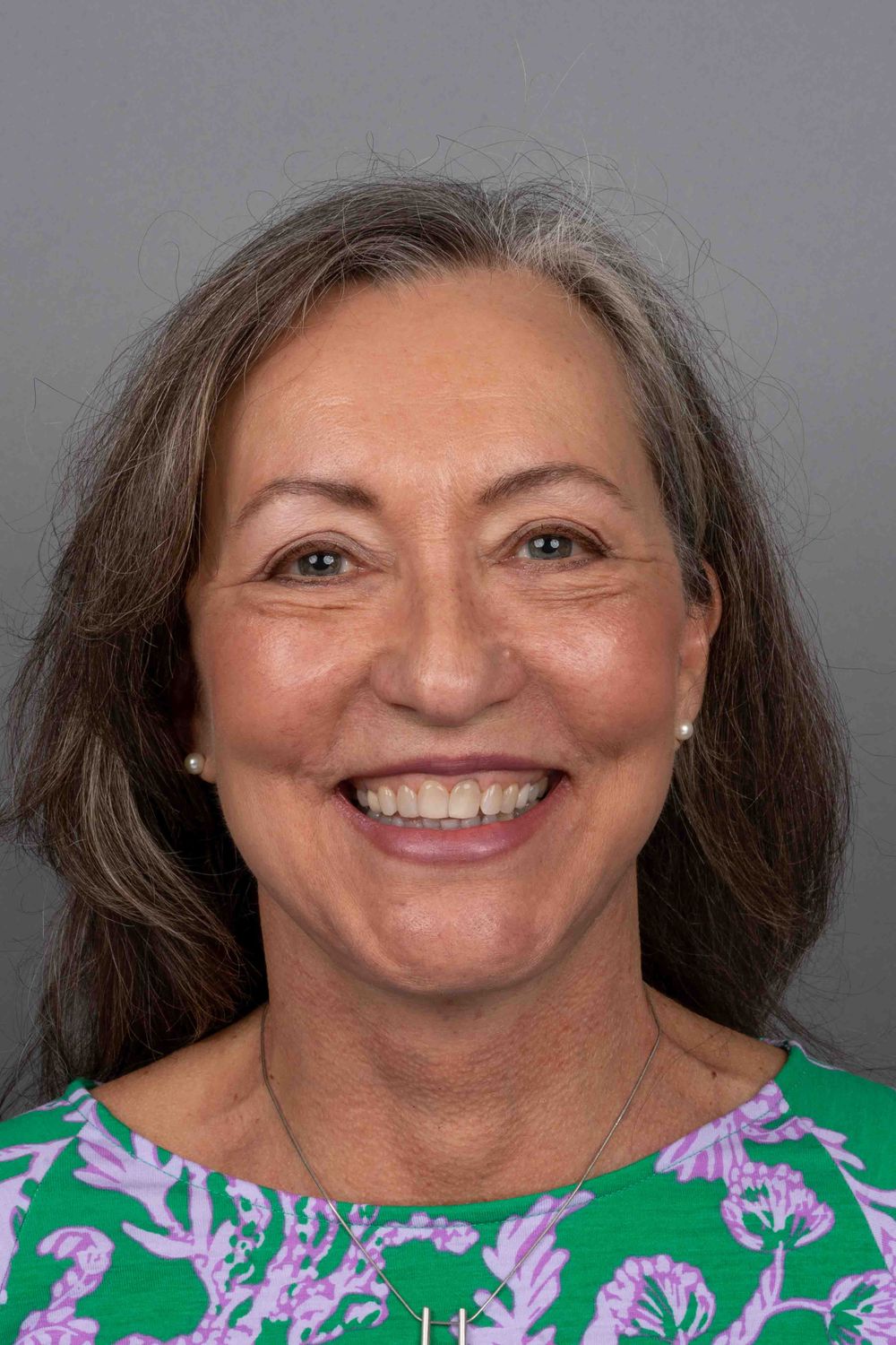 face/neck patient before & After