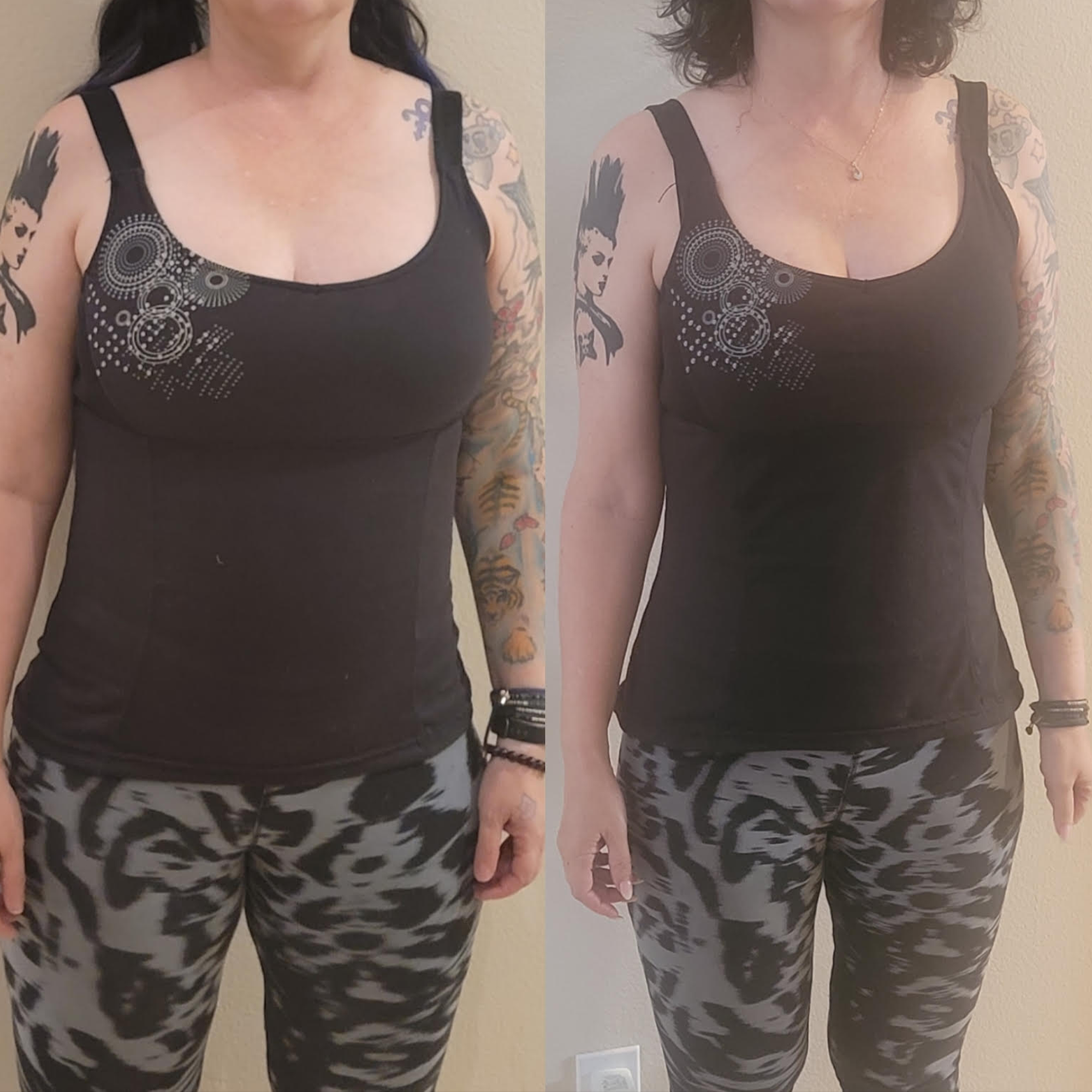 weight loss before and after