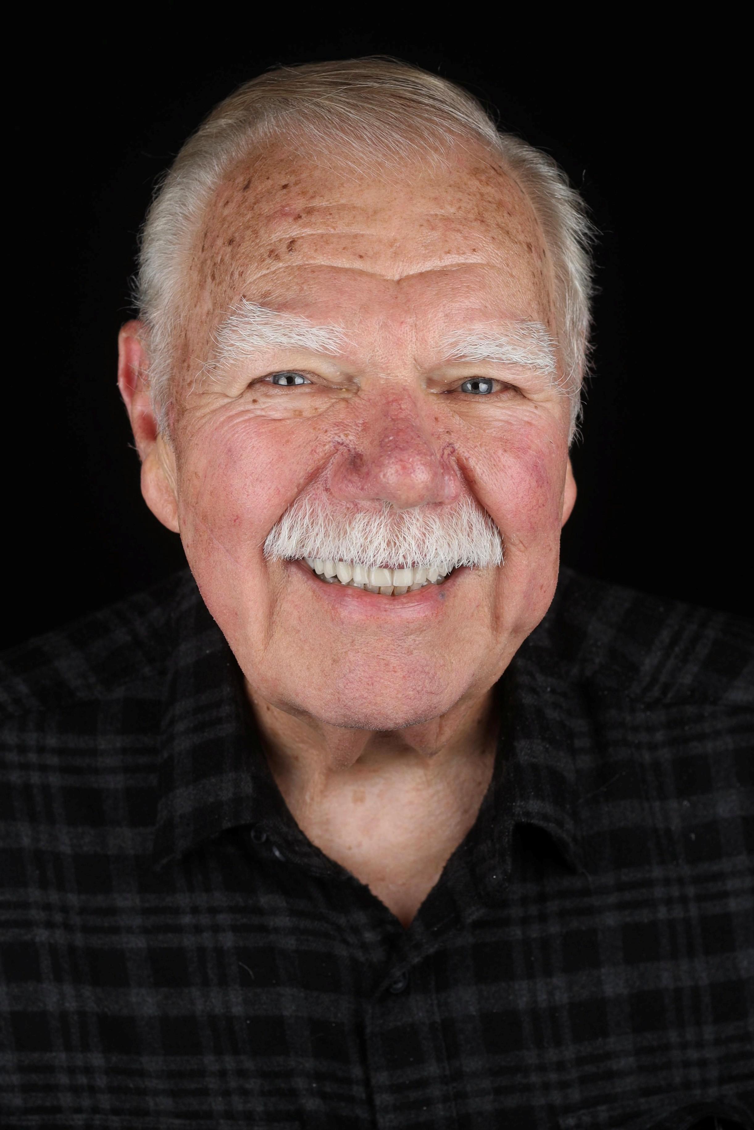 dental implants patient after