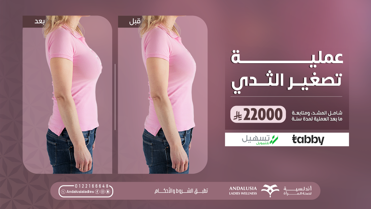 تبييض اسنان بتقنية الزوم عيادة تبييض اسنان بتقنية الزوم افضل عيادة للاسنان بجدة والسعودية