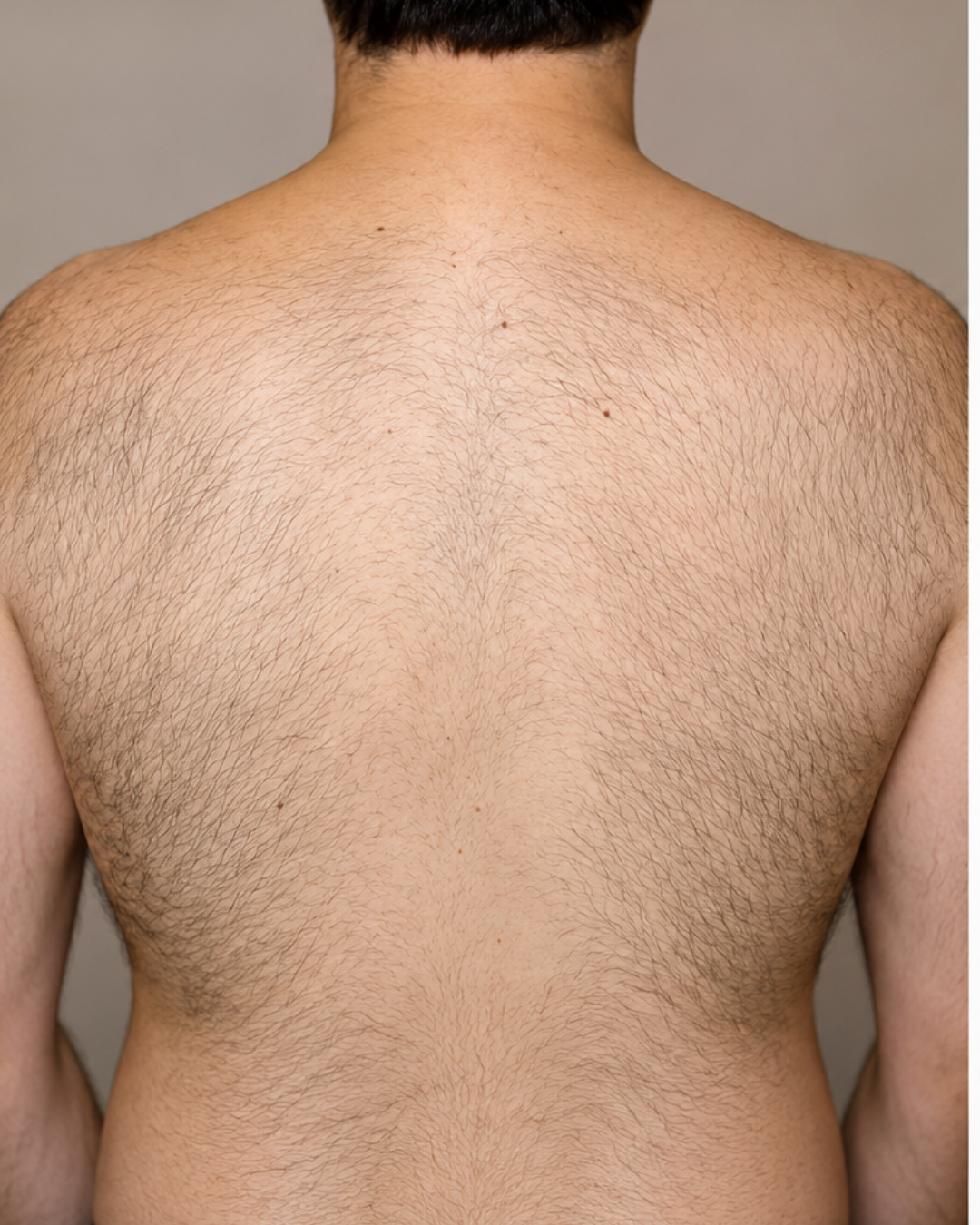 Before image