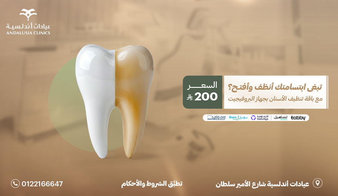 تبييض اسنان بتقنية الزوم عيادة تبييض اسنان بتقنية الزوم افضل عيادة للاسنان بجدة والسعودية