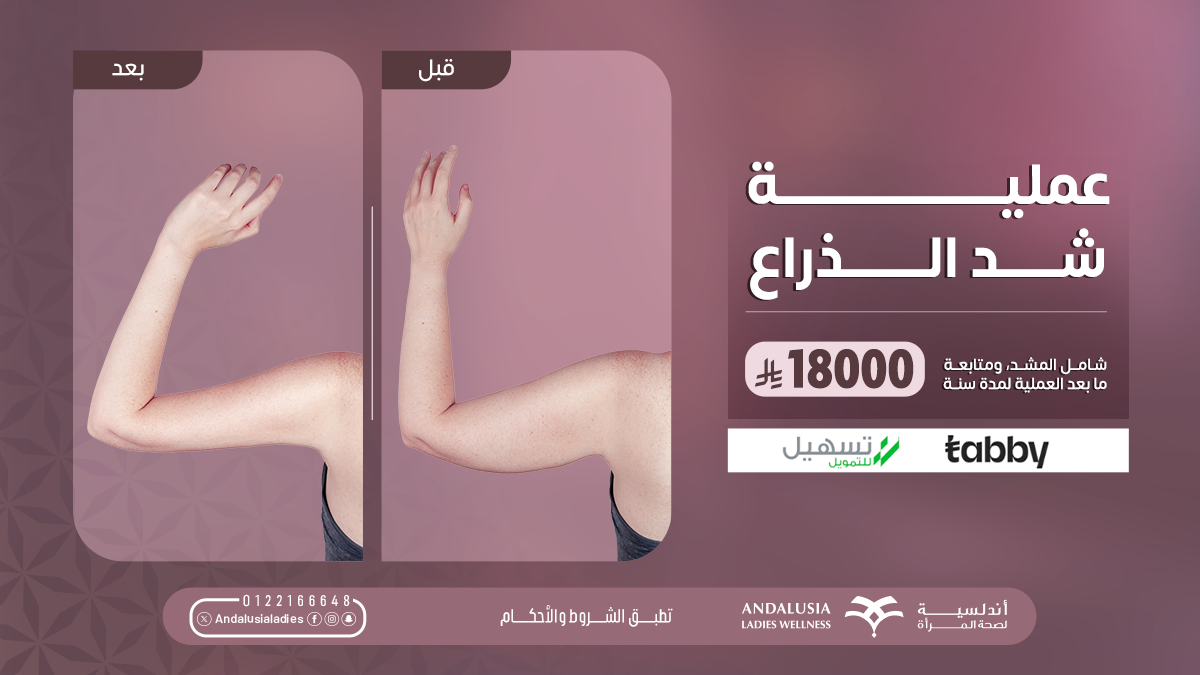 تبييض اسنان بتقنية الزوم عيادة تبييض اسنان بتقنية الزوم افضل عيادة للاسنان بجدة والسعودية