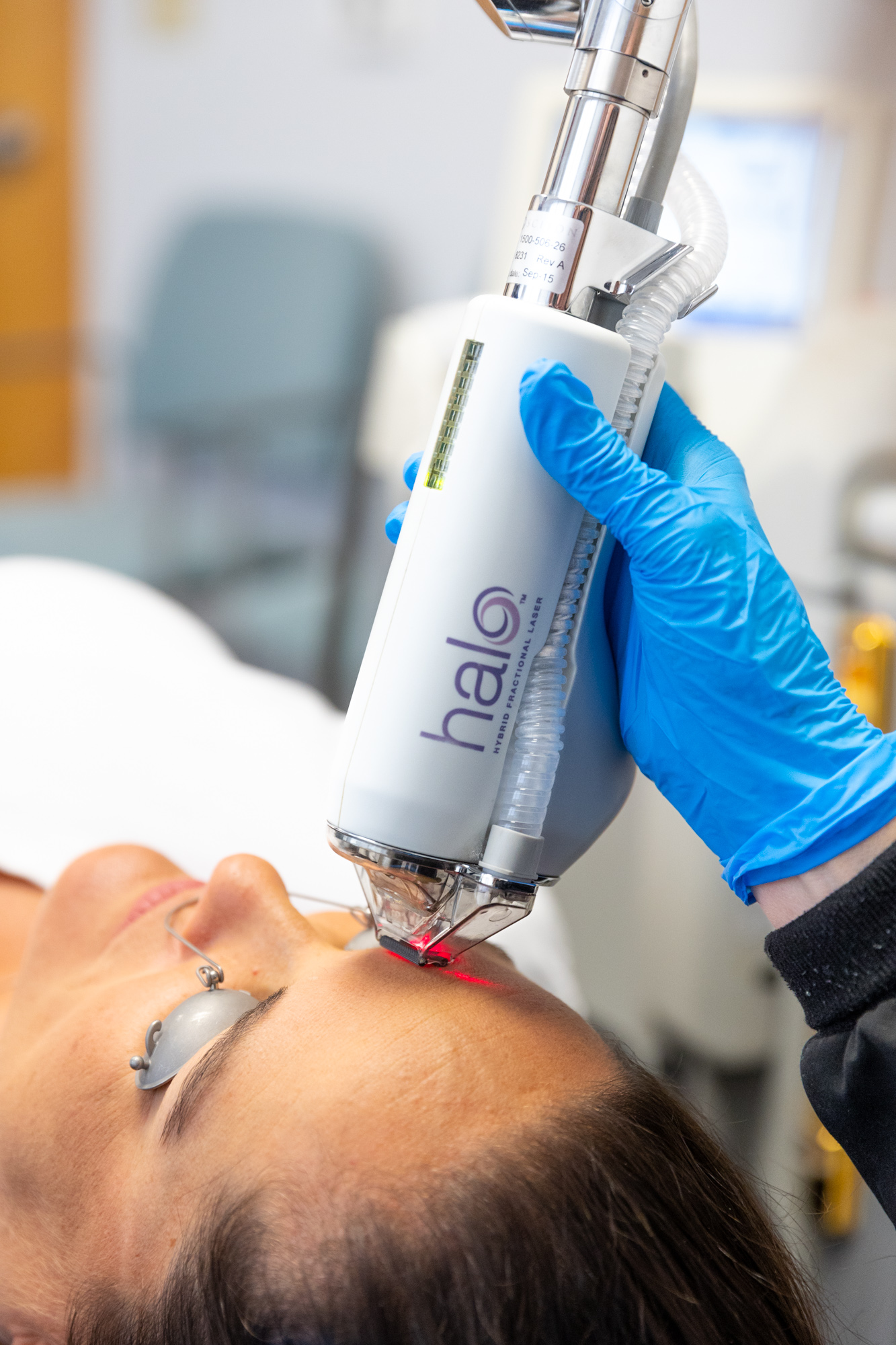 Halo Laser Resurfacing