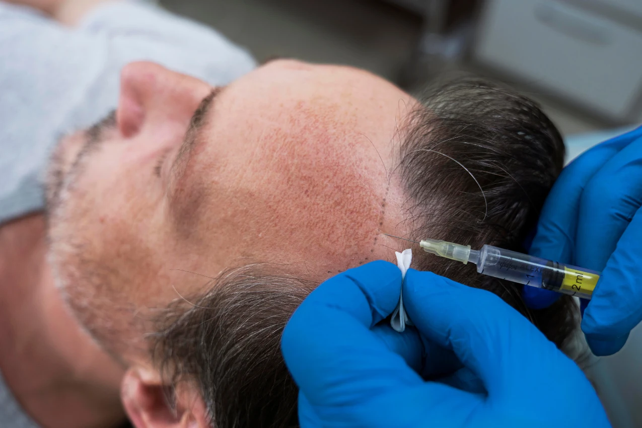 Formation Tricopigmentation