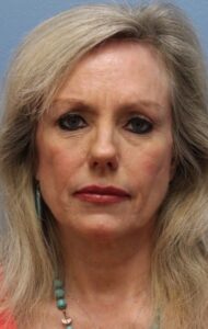 Facelift Before & after