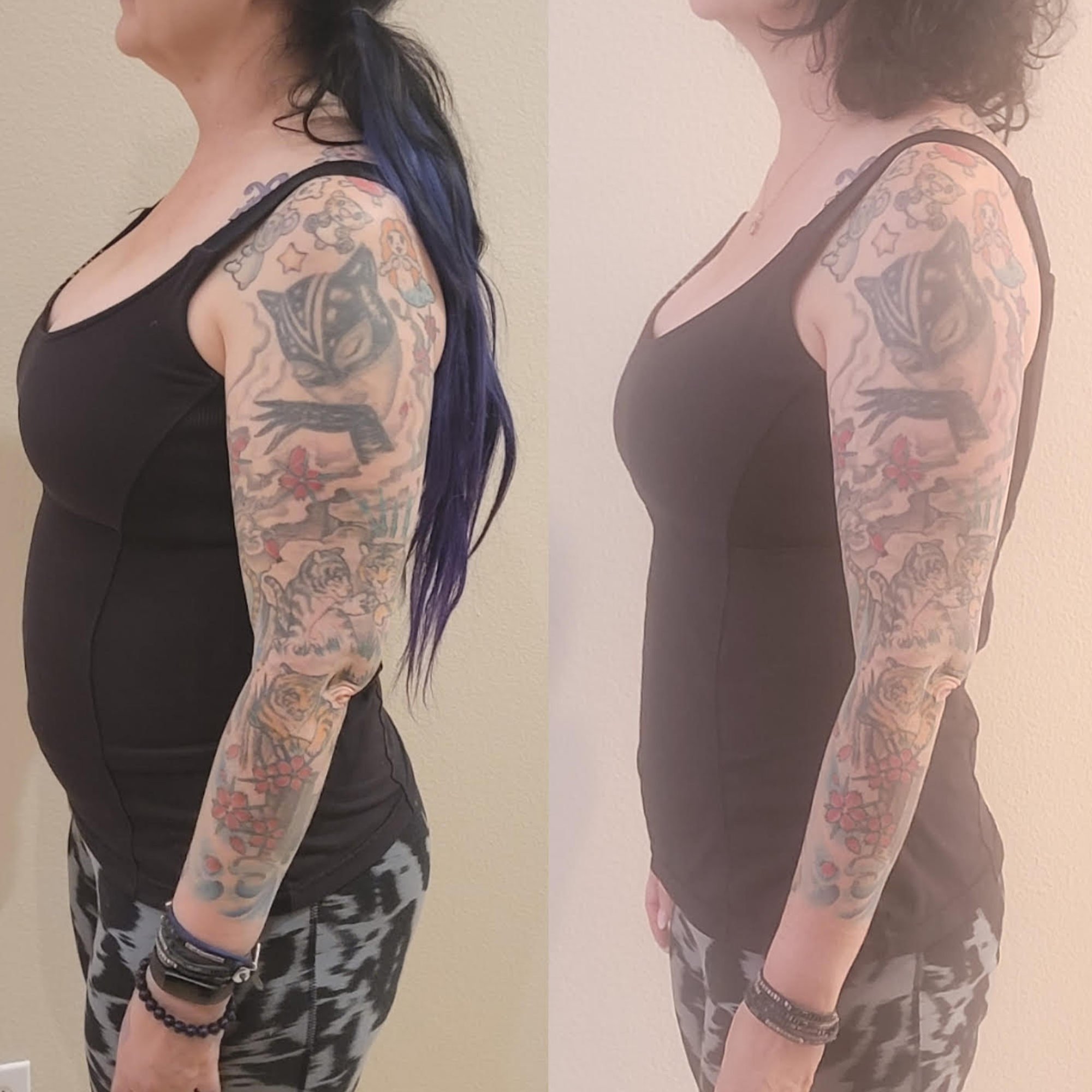 weight loss before and after