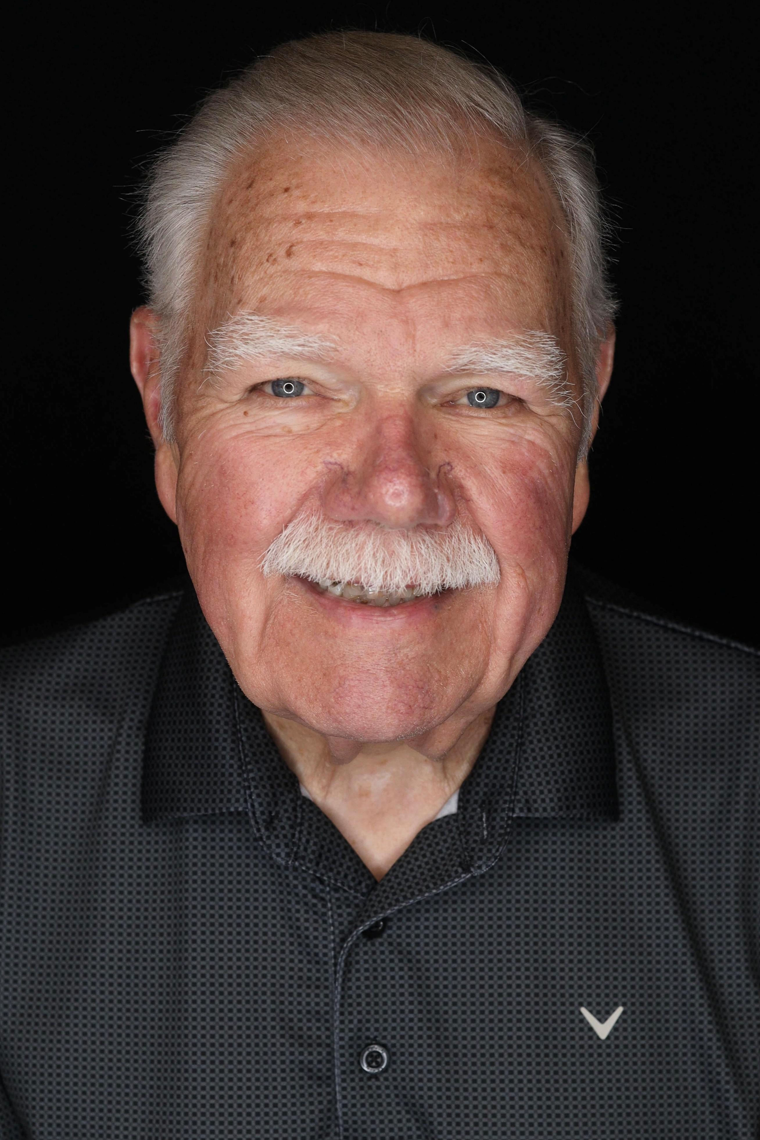 dental implants patient before